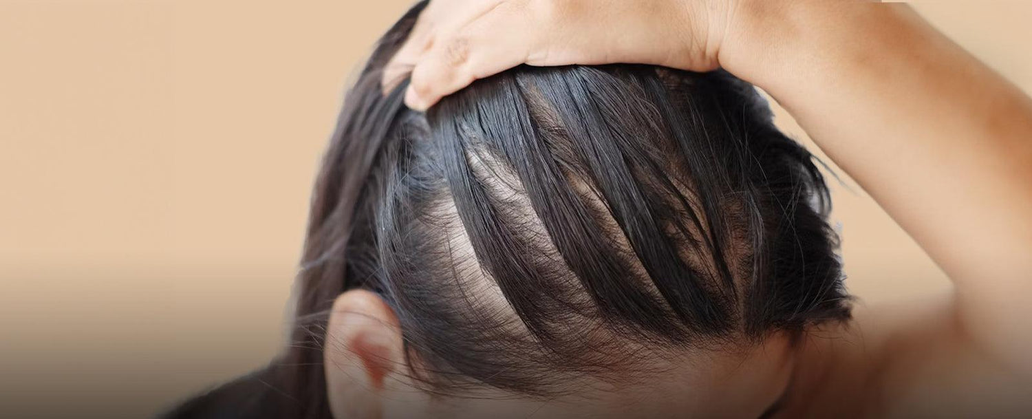 Are you concerned about hair thinning or loss? - La Pink